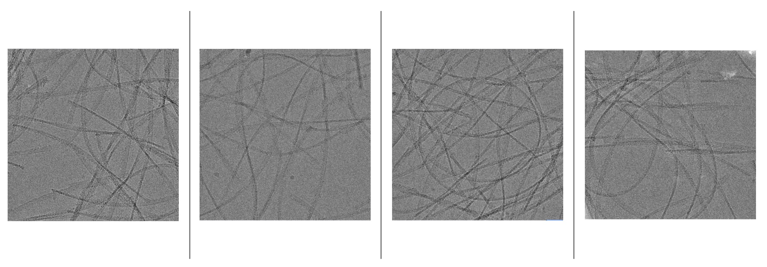 Serum Amyloid A exposures